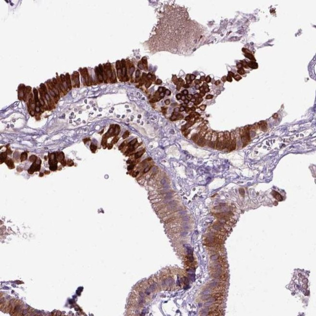 DEPDC1B Antibody in Immunohistochemistry (IHC)