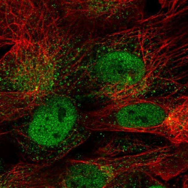 CDR1 Antibody in Immunocytochemistry (ICC/IF)