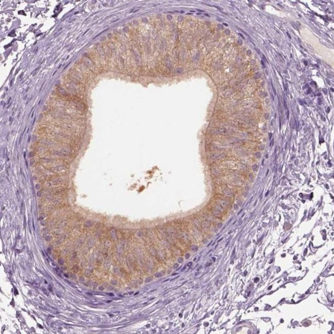 CLPSL1 Antibody in Immunohistochemistry (IHC)