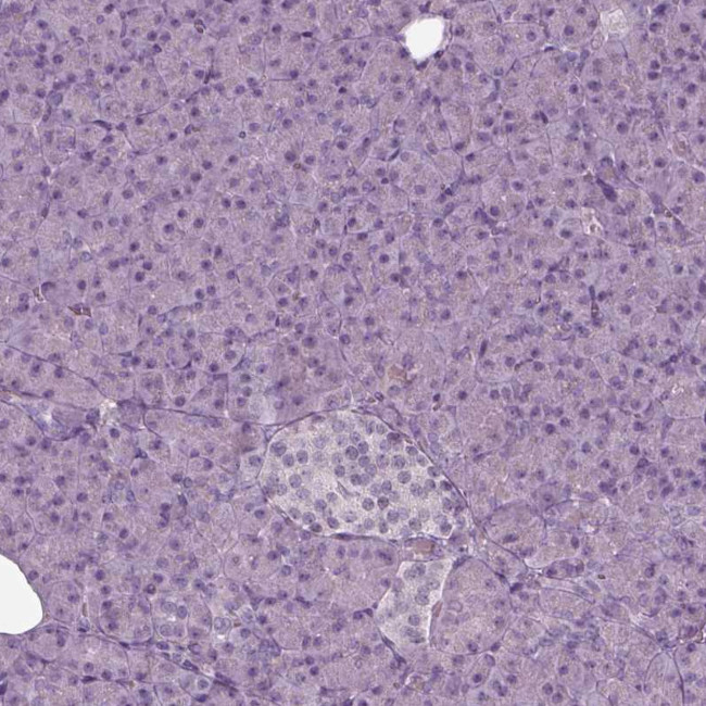 Septin-14 Antibody in Immunohistochemistry (Paraffin) (IHC (P))
