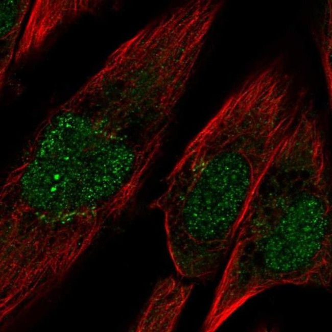 PCDH10 Antibody in Immunocytochemistry (ICC/IF)