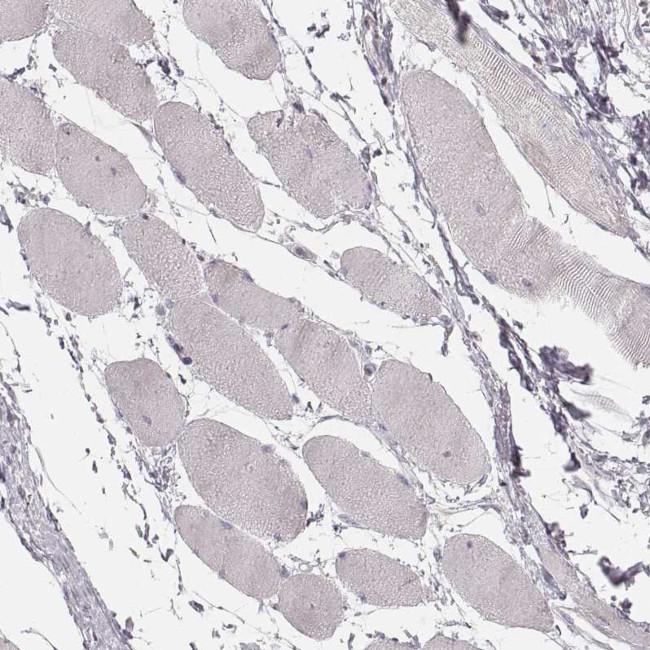 PCDHA4 Antibody in Immunohistochemistry (Paraffin) (IHC (P))