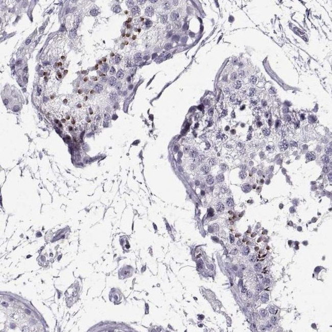 RNF32 Antibody in Immunohistochemistry (IHC)