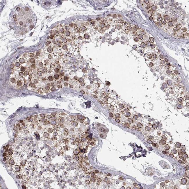 NUP37 Antibody in Immunohistochemistry (Paraffin) (IHC (P))