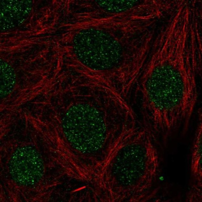 LMX1B Antibody in Immunocytochemistry (ICC/IF)