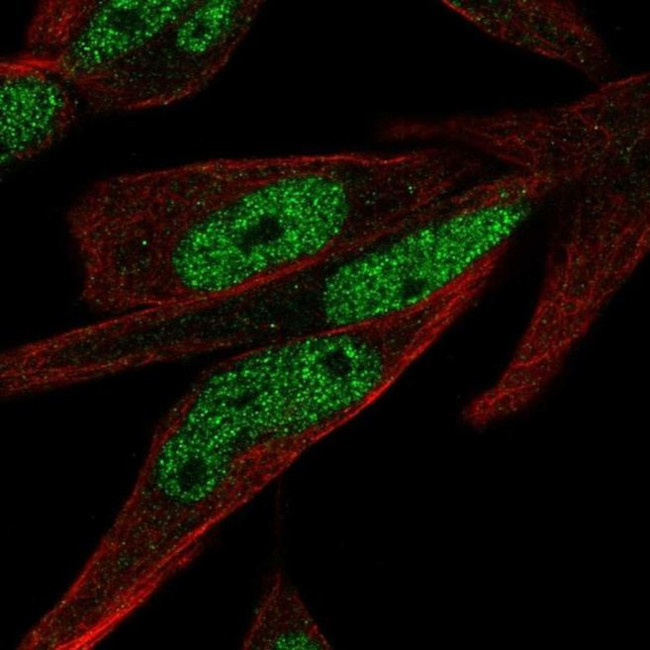 ZNF225 Antibody in Immunocytochemistry (ICC/IF)