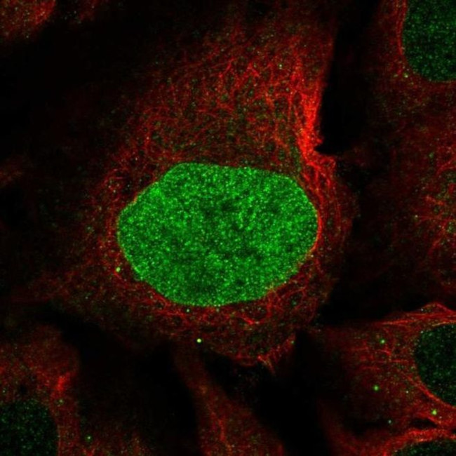 Calpain 8 Antibody in Immunocytochemistry (ICC/IF)