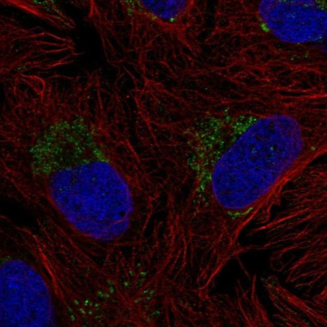 ZNF625 Antibody in Immunocytochemistry (ICC/IF)