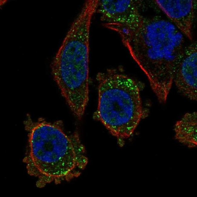TGFBR3L Antibody in Immunocytochemistry (ICC/IF)
