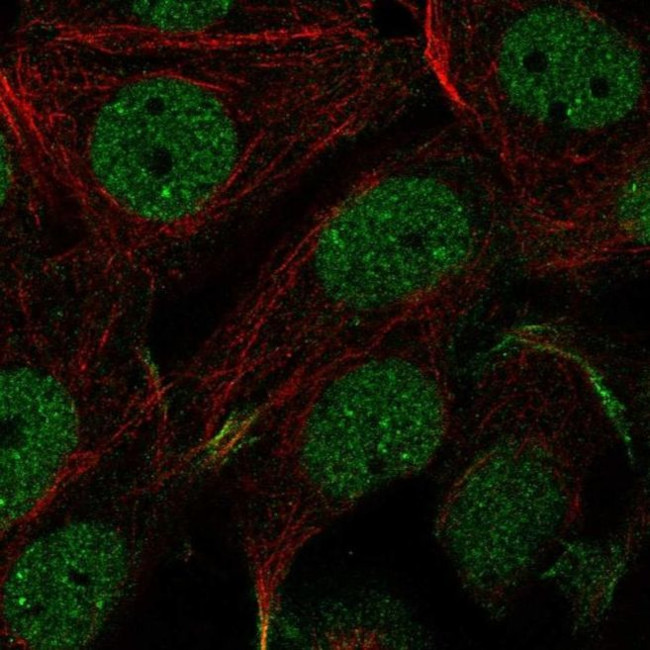C11orf71 Antibody in Immunocytochemistry (ICC/IF)