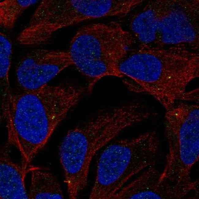 ST7L Antibody in Immunocytochemistry (ICC/IF)