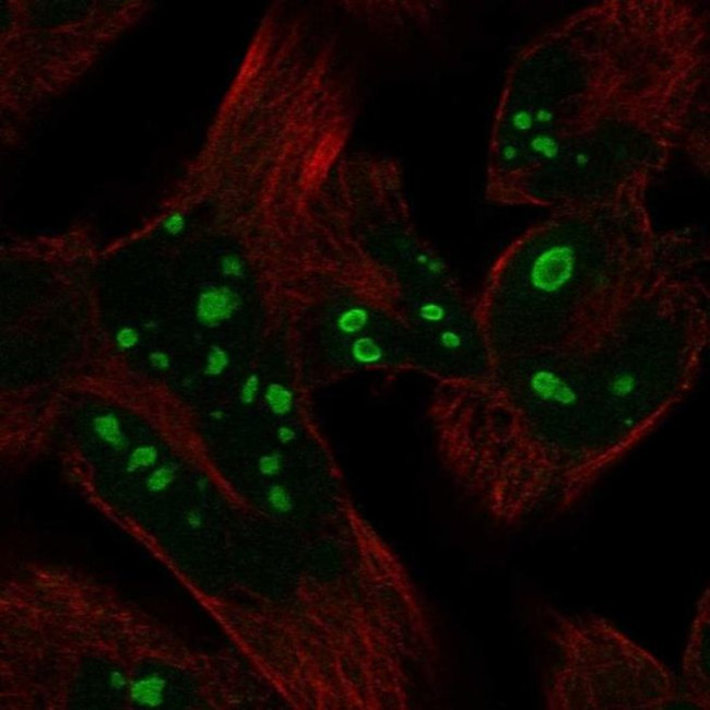 HERPUD2 Antibody in Immunocytochemistry (ICC/IF)