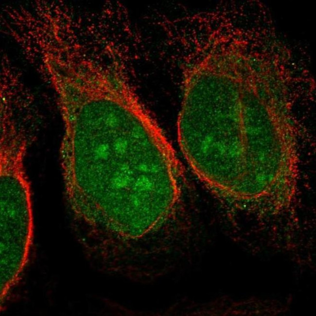 CHD3 Antibody in Immunocytochemistry (ICC/IF)