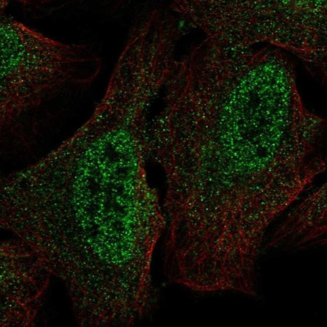 CSDC2 Antibody in Immunocytochemistry (ICC/IF)