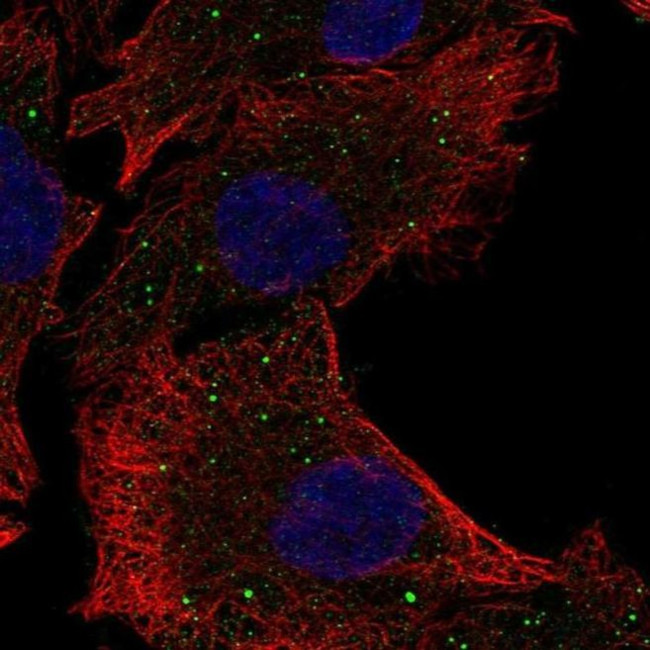 mPR gamma Antibody in Immunocytochemistry (ICC/IF)