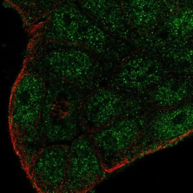 SMIM22 Antibody in Immunocytochemistry (ICC/IF)