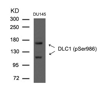 Phospho-DLC1 (Ser986) Antibody in Western Blot (WB)