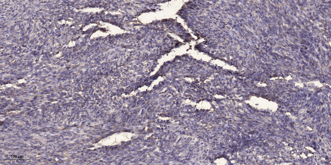 Phospho-SQSTM1 (Ser403) Antibody in Immunohistochemistry (Paraffin) (IHC (P))