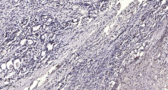 Phospho-LRP6 (Ser1490) Antibody in Immunohistochemistry (Paraffin) (IHC (P))