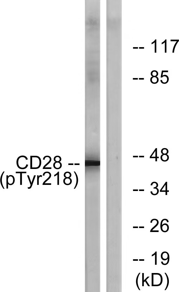Phospho-CD28 (Tyr218) Antibody in Western Blot (WB)
