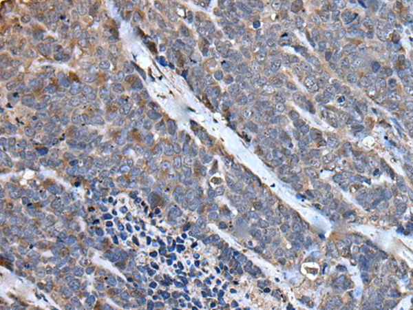MCM10 Antibody in Immunohistochemistry (Paraffin) (IHC (P))