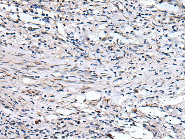 QSOX1 Antibody in Immunohistochemistry (Paraffin) (IHC (P))