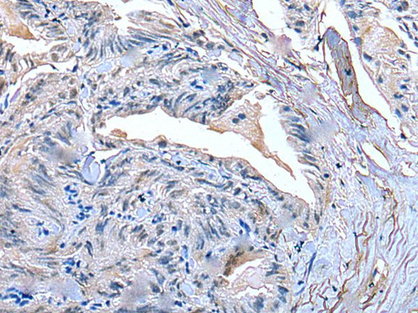 SLC27A4 Antibody in Immunohistochemistry (Paraffin) (IHC (P))