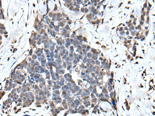 ATF6-beta Antibody in Immunohistochemistry (Paraffin) (IHC (P))