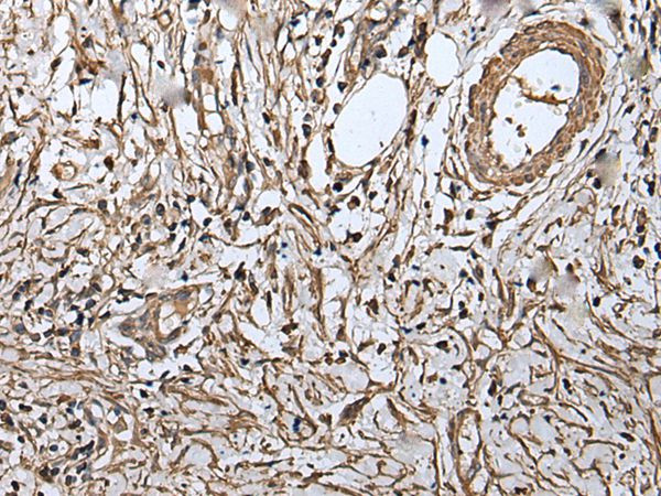 RUFY4 Antibody in Immunohistochemistry (Paraffin) (IHC (P))