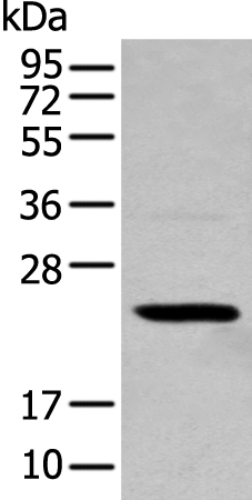 TCEAL4 Antibody in Western Blot (WB)