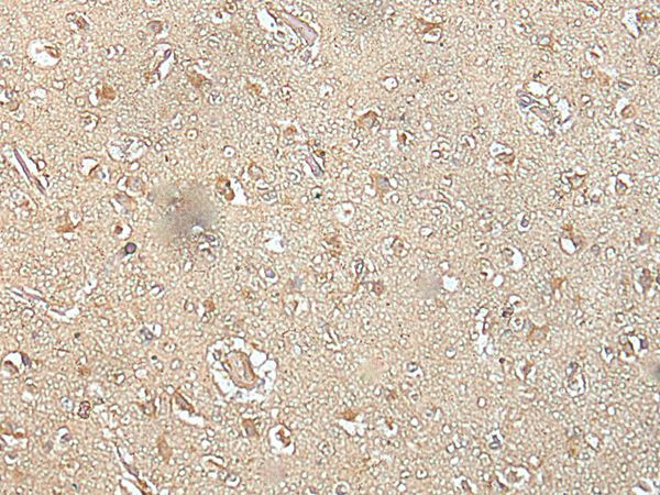 SPIC Antibody in Immunohistochemistry (Paraffin) (IHC (P))