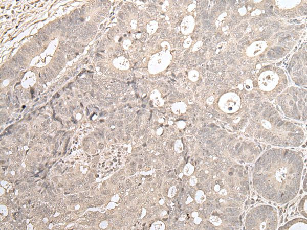 ZNF138 Antibody in Immunohistochemistry (Paraffin) (IHC (P))