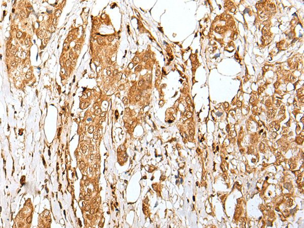 ZMAT2 Antibody in Immunohistochemistry (Paraffin) (IHC (P))