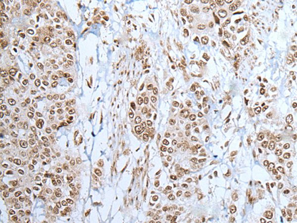 ZNF302 Antibody in Immunohistochemistry (Paraffin) (IHC (P))