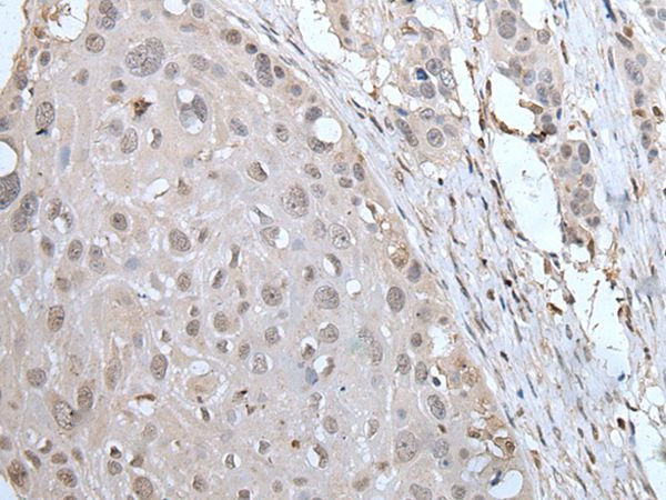 YPEL2 Antibody in Immunohistochemistry (Paraffin) (IHC (P))