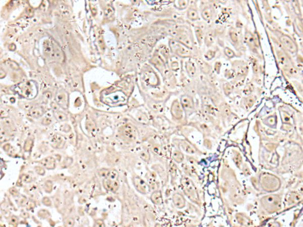 VRK3 Antibody in Immunohistochemistry (Paraffin) (IHC (P))