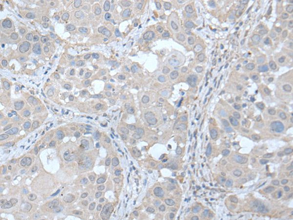 UBE2Q2 Antibody in Immunohistochemistry (Paraffin) (IHC (P))