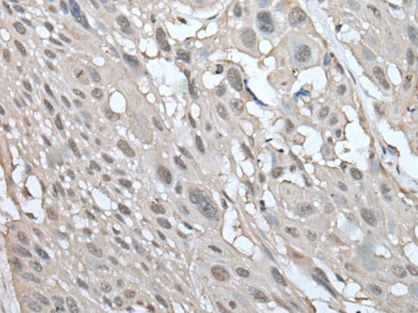 UBE2W Antibody in Immunohistochemistry (Paraffin) (IHC (P))