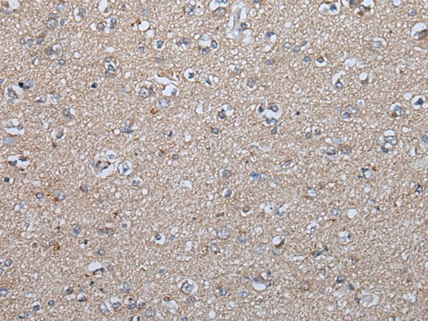 FGF5 Antibody in Immunohistochemistry (Paraffin) (IHC (P))