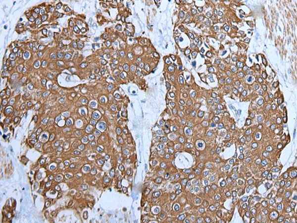 TRPC5 Antibody in Immunohistochemistry (Paraffin) (IHC (P))