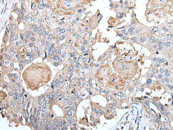 Claudin 6 Antibody in Immunohistochemistry (Paraffin) (IHC (P))