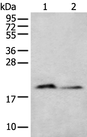 KRTAP11-1 Antibody in Western Blot (WB)