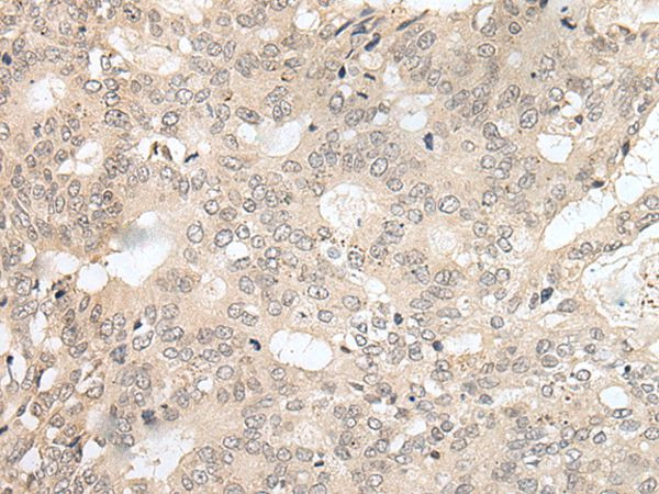 HOXA2 Antibody in Immunohistochemistry (Paraffin) (IHC (P))