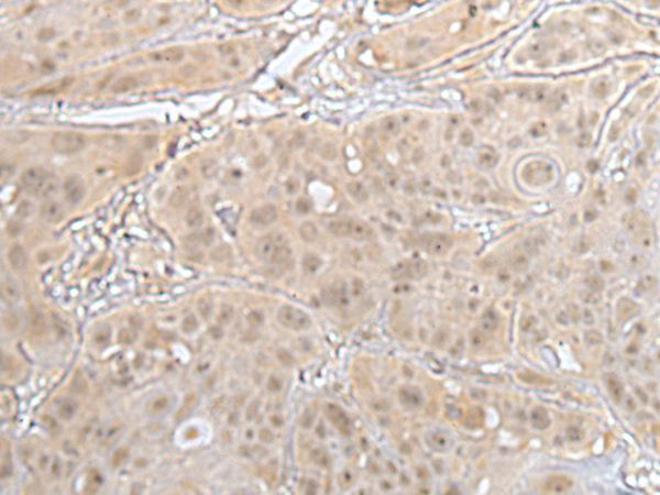 HOXD3 Antibody in Immunohistochemistry (Paraffin) (IHC (P))
