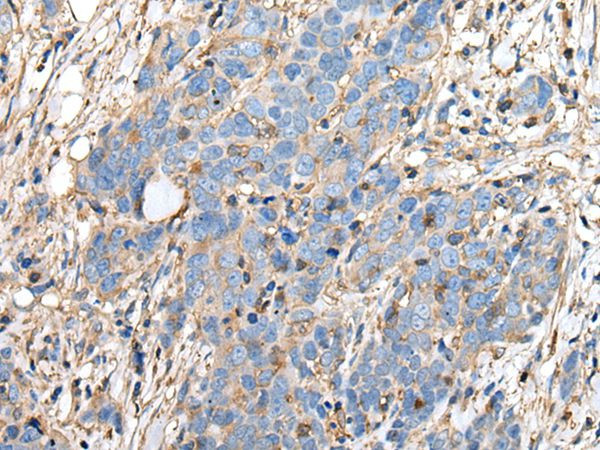 HRASLS3 Antibody in Immunohistochemistry (Paraffin) (IHC (P))