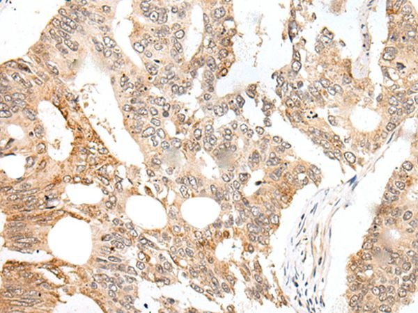 CASC5 Antibody in Immunohistochemistry (Paraffin) (IHC (P))