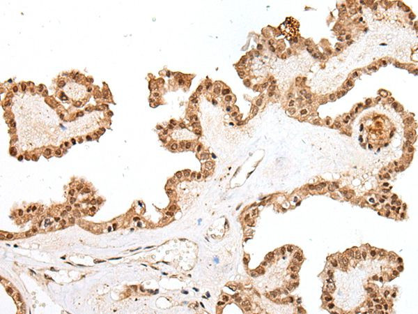 PTOV1 Antibody in Immunohistochemistry (Paraffin) (IHC (P))