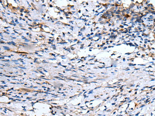 EMP1 Antibody in Immunohistochemistry (Paraffin) (IHC (P))