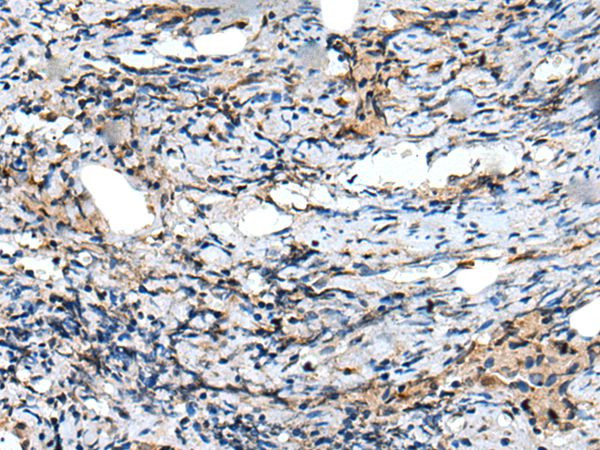 CXCL6 Antibody in Immunohistochemistry (Paraffin) (IHC (P))