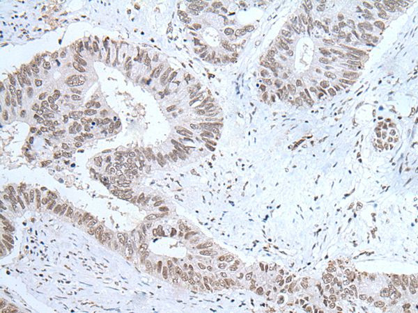 Orexin Antibody in Immunohistochemistry (Paraffin) (IHC (P))